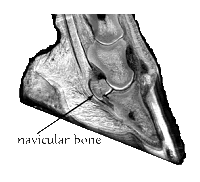 Navicular Syndrome